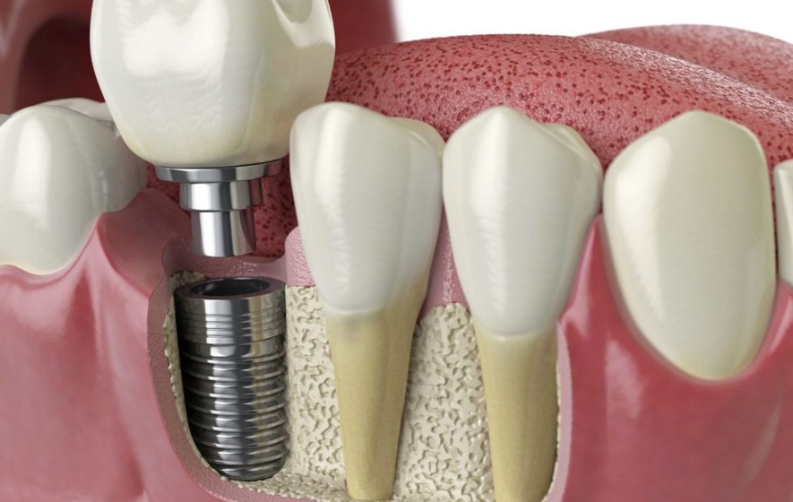 Sandton Dental Clinic - Dr's Peer