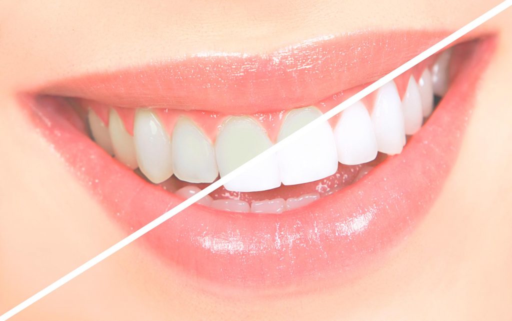 Sandton Dental Clinic - Dr's Peer